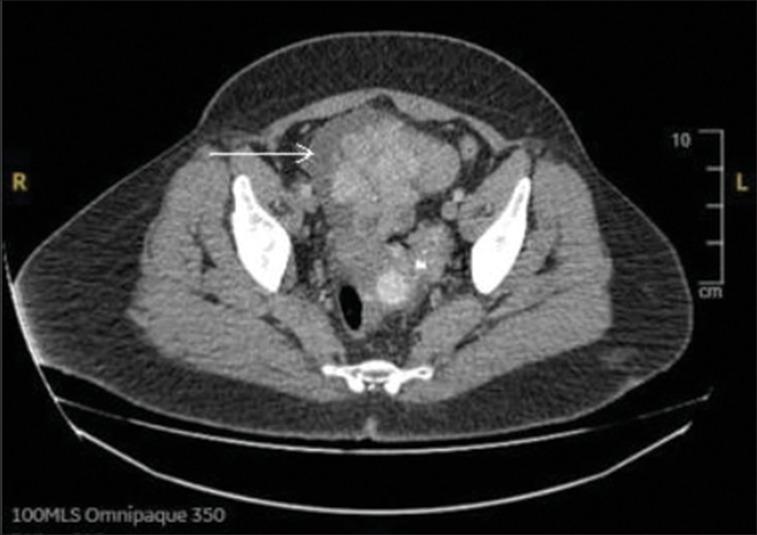 https://cdn.ncbi.nlm.nih.gov/pmc/blobs/f5fe/11604200/1dd07c5af0b2/HV-25-106-g002.jpg