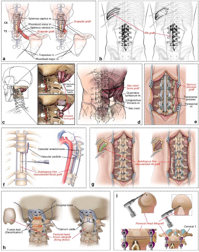 https://cdn.ncbi.nlm.nih.gov/pmc/blobs/f5fe/12145720/0b3f5b23b197/gr4.jpg