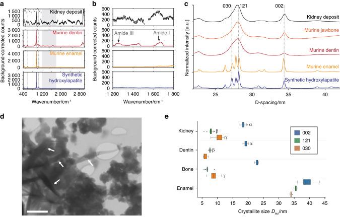 https://cdn.ncbi.nlm.nih.gov/pmc/blobs/f602/10703793/4d84852ed40a/41368_2023_257_Fig11_HTML.jpg