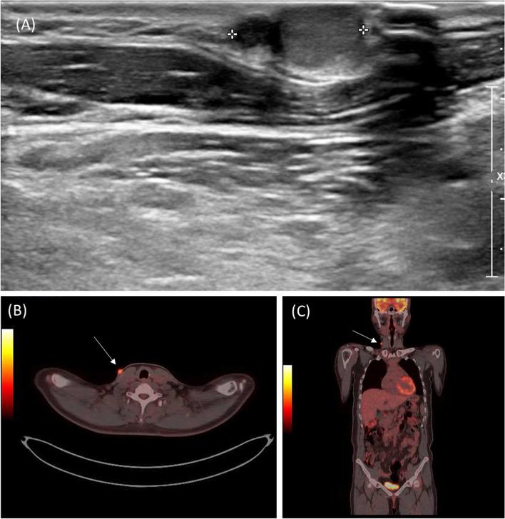 https://cdn.ncbi.nlm.nih.gov/pmc/blobs/f603/9936773/3449cb9f0ad0/12957_2023_2937_Fig2_HTML.jpg