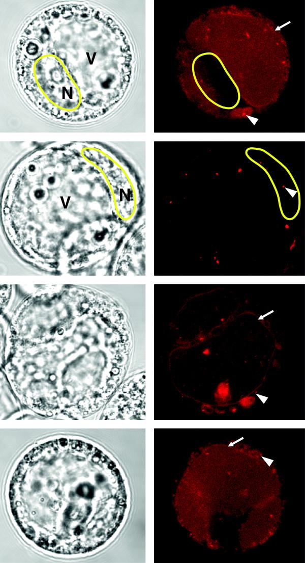 https://cdn.ncbi.nlm.nih.gov/pmc/blobs/f608/4076440/545ba2e51141/1746-4811-10-15-2.jpg