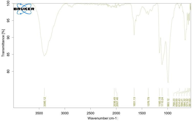 https://cdn.ncbi.nlm.nih.gov/pmc/blobs/f614/11323196/9df7c0f765ef/cureus-0016-00000064558-i01.jpg