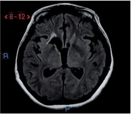 https://cdn.ncbi.nlm.nih.gov/pmc/blobs/f61a/3093228/85560e6cd3ae/ni-2009-1-e22-g001.jpg