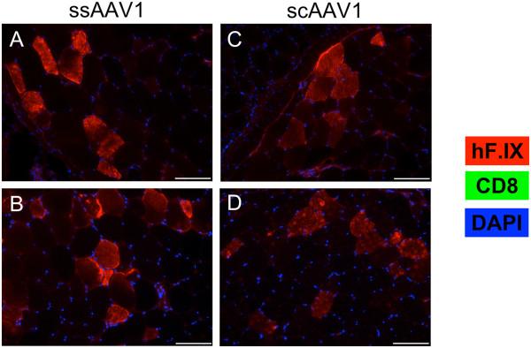 https://cdn.ncbi.nlm.nih.gov/pmc/blobs/f62e/3904690/d0e9bc87e233/1479-5876-12-25-4.jpg