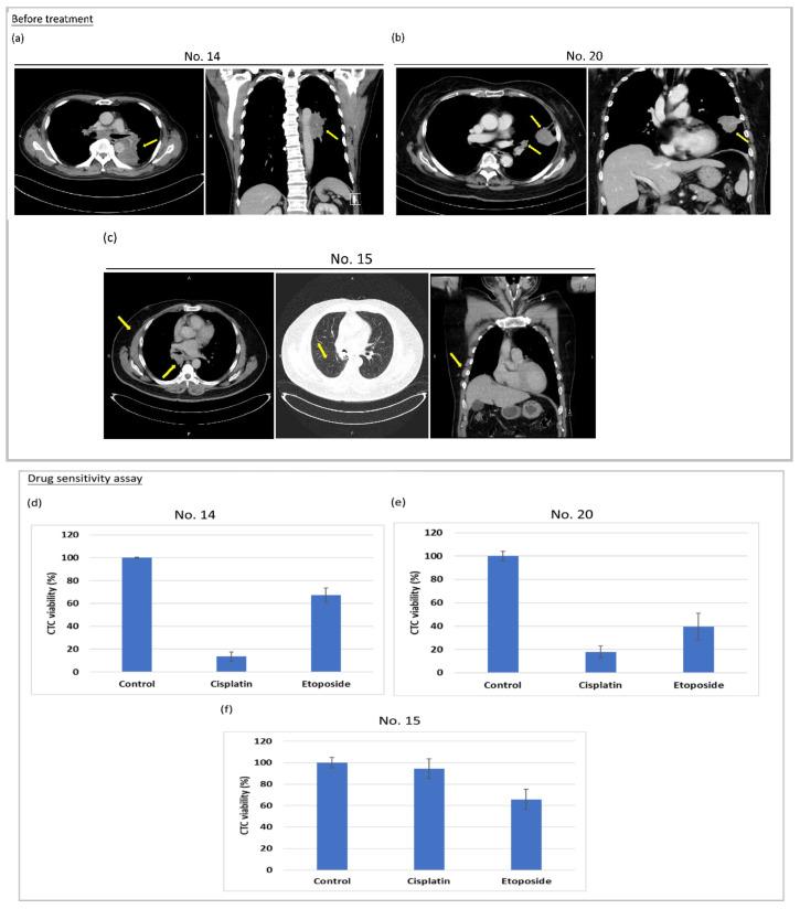 https://cdn.ncbi.nlm.nih.gov/pmc/blobs/f636/7696848/2731f72dcb3e/cancers-12-03394-g005a.jpg