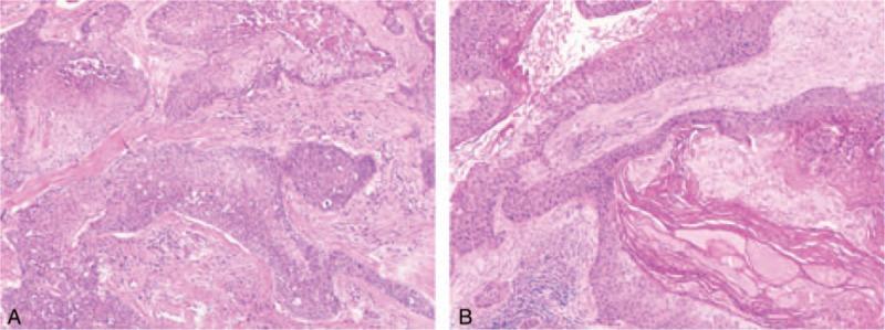 https://cdn.ncbi.nlm.nih.gov/pmc/blobs/f637/5369919/3ad245983890/medi-96-e6341-g004.jpg
