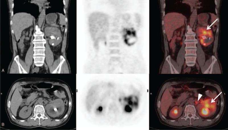 https://cdn.ncbi.nlm.nih.gov/pmc/blobs/f637/5369919/f77e906aa660/medi-96-e6341-g003.jpg