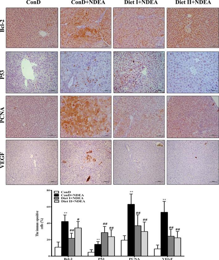https://cdn.ncbi.nlm.nih.gov/pmc/blobs/f64c/6341211/ad43492b28b6/FSN3-7-339-g004.jpg