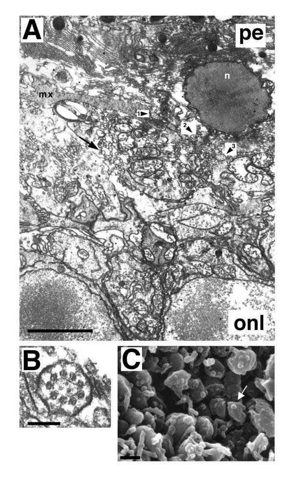 https://cdn.ncbi.nlm.nih.gov/pmc/blobs/f656/548520/183fd29f6041/1471-2202-6-5-3.jpg