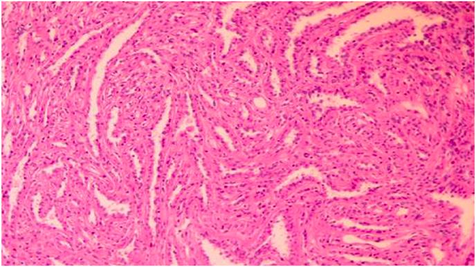 https://cdn.ncbi.nlm.nih.gov/pmc/blobs/f659/10248790/f404a416c405/gr3.jpg