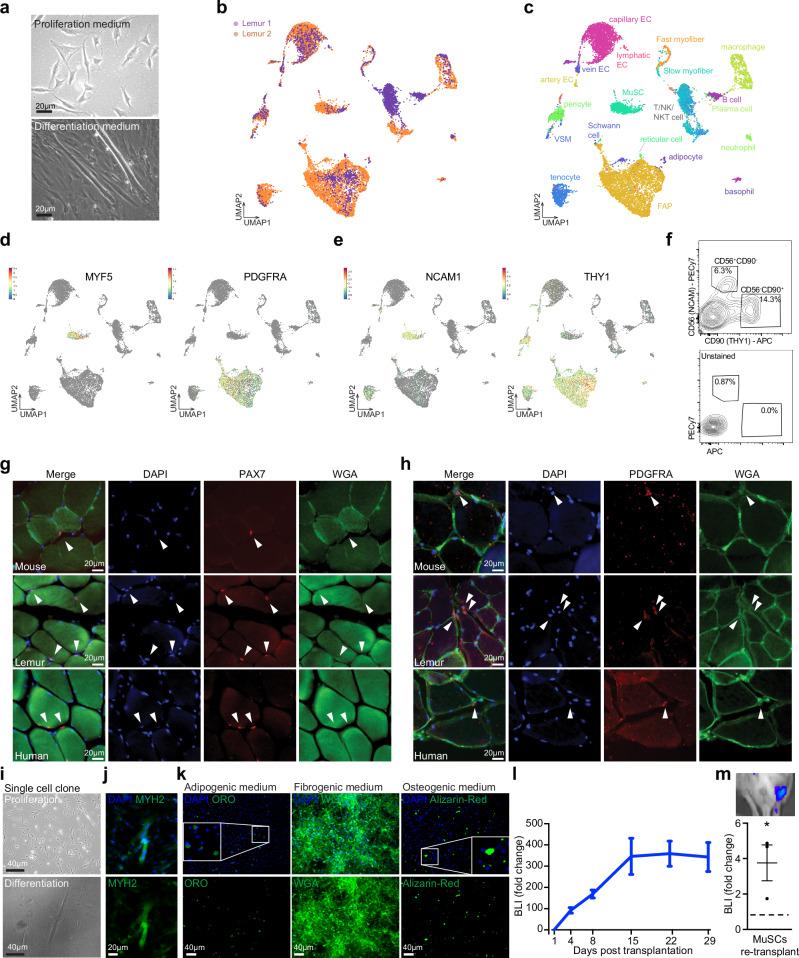 https://cdn.ncbi.nlm.nih.gov/pmc/blobs/f65a/12187938/b2f21fb82e0b/41467_2025_58897_Fig1_HTML.jpg