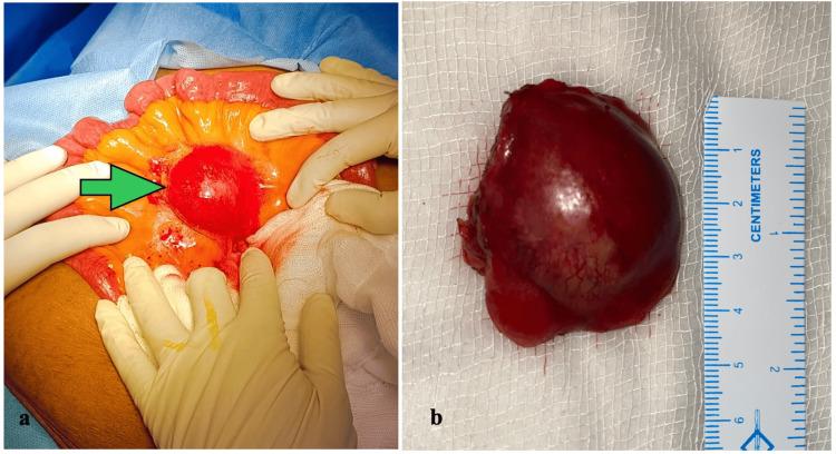 https://cdn.ncbi.nlm.nih.gov/pmc/blobs/f667/11219578/5a888e48df79/cureus-0016-00000061549-i02.jpg