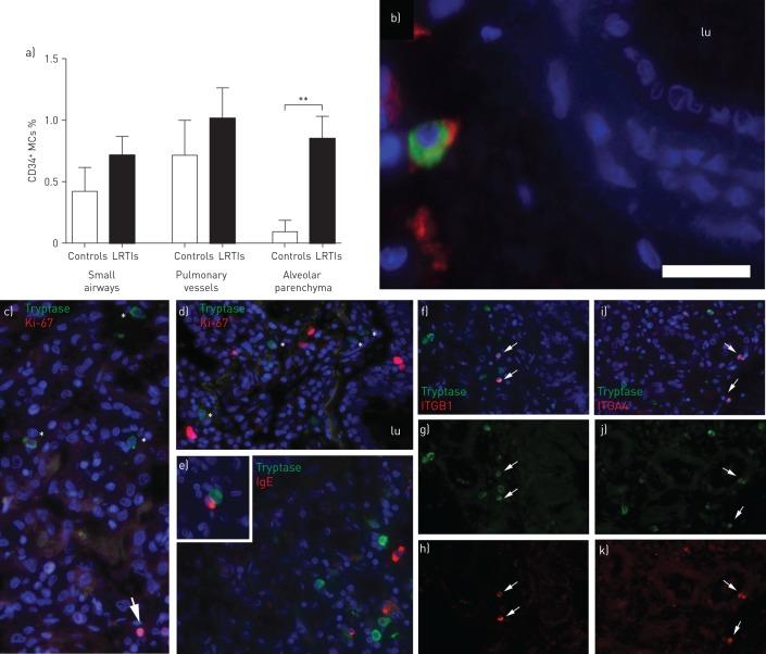 https://cdn.ncbi.nlm.nih.gov/pmc/blobs/f667/6250563/9966fb184cb0/00038-2018.03.jpg