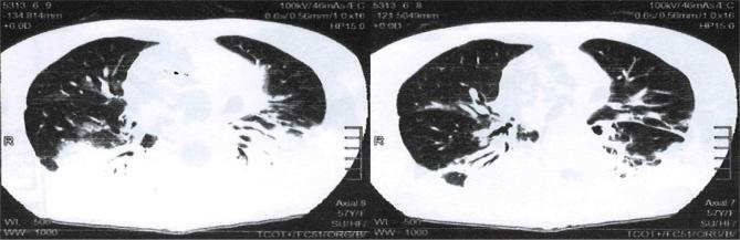 https://cdn.ncbi.nlm.nih.gov/pmc/blobs/f669/10545148/7f0936279deb/4043_Fig1.jpg