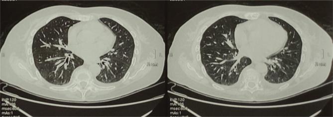 https://cdn.ncbi.nlm.nih.gov/pmc/blobs/f669/10545148/a9f898d4a059/4043_Fig2.jpg