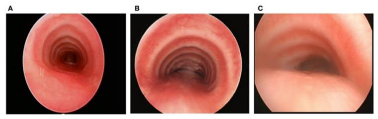 https://cdn.ncbi.nlm.nih.gov/pmc/blobs/f66a/10299191/7df00ec24a84/jcm-12-03947-g001.jpg