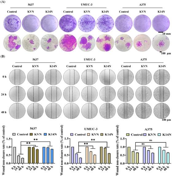 https://cdn.ncbi.nlm.nih.gov/pmc/blobs/f66a/11742431/2a83bf615a9b/MCO2-6-e70068-g007.jpg