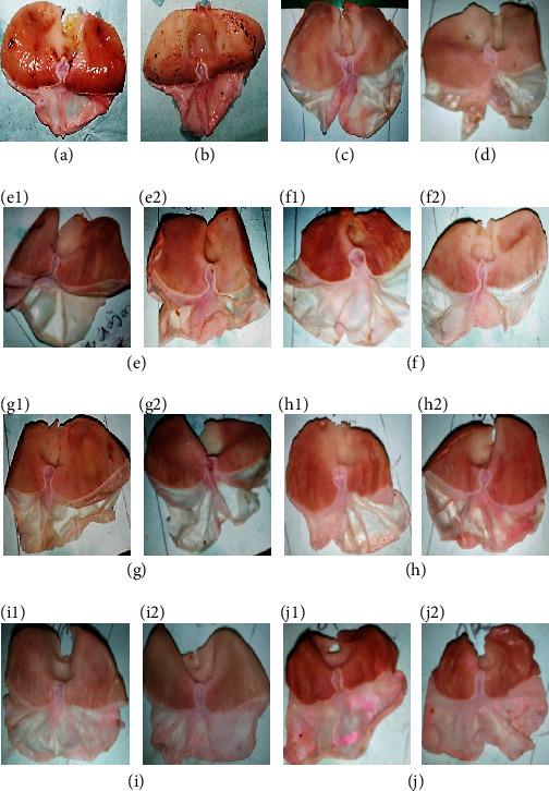https://cdn.ncbi.nlm.nih.gov/pmc/blobs/f66c/9842419/2f5744e28598/BMRI2023-2657278.002.jpg