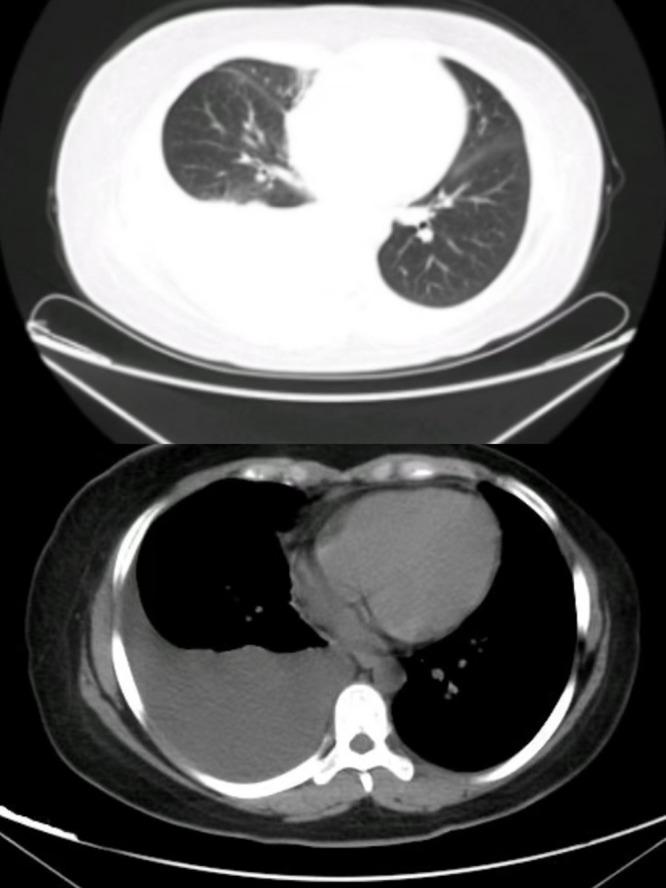 https://cdn.ncbi.nlm.nih.gov/pmc/blobs/f670/11378985/f8a6fb342f0e/CCID-17-1975-g0002.jpg