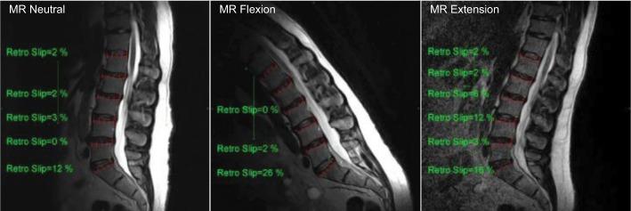 https://cdn.ncbi.nlm.nih.gov/pmc/blobs/f68a/6216966/07317c0de600/jpr-11-2687Fig8.jpg