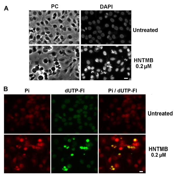 https://cdn.ncbi.nlm.nih.gov/pmc/blobs/f68b/2836302/77544d12a8b7/1471-2407-10-72-4.jpg
