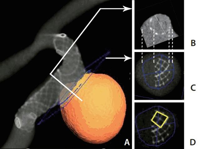 https://cdn.ncbi.nlm.nih.gov/pmc/blobs/f695/6132037/884ca9f60f63/neuroint-2018-00976f3.jpg