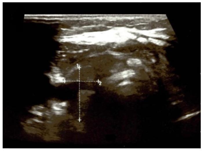https://cdn.ncbi.nlm.nih.gov/pmc/blobs/f699/11432308/e4d07366cfbb/jcm-13-05347-g002.jpg