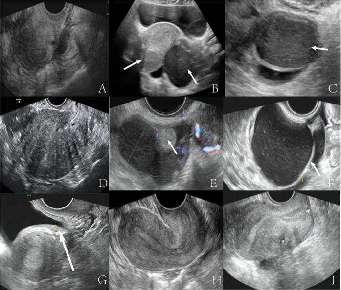 https://cdn.ncbi.nlm.nih.gov/pmc/blobs/f69a/12009384/d180659efe41/41598_2025_96093_Fig2_HTML.jpg