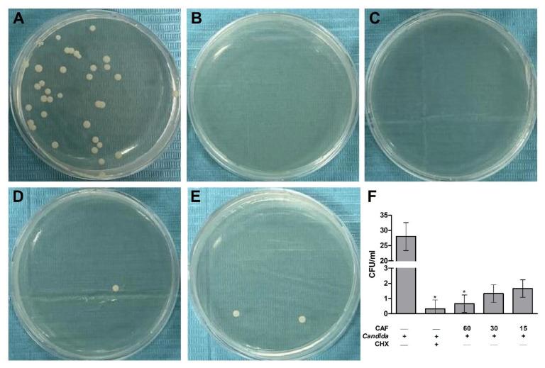 https://cdn.ncbi.nlm.nih.gov/pmc/blobs/f6a0/9495344/5be5f07143ef/biomedicines-10-02078-g006.jpg