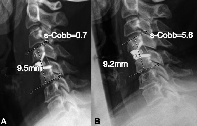 https://cdn.ncbi.nlm.nih.gov/pmc/blobs/f6a1/10188236/3c159967e4d6/cureus-0015-00000038864-i09.jpg