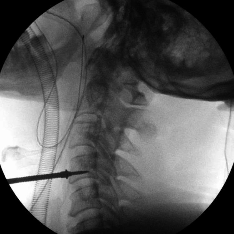 https://cdn.ncbi.nlm.nih.gov/pmc/blobs/f6a1/10188236/55fc4f96e8e0/cureus-0015-00000038864-i01.jpg