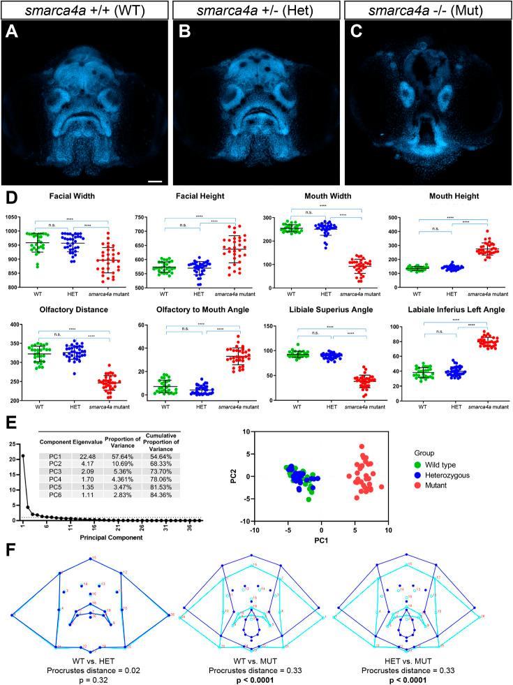 https://cdn.ncbi.nlm.nih.gov/pmc/blobs/f6a3/10245138/0cbe5d8c09be/dmm-16-049868-g4.jpg