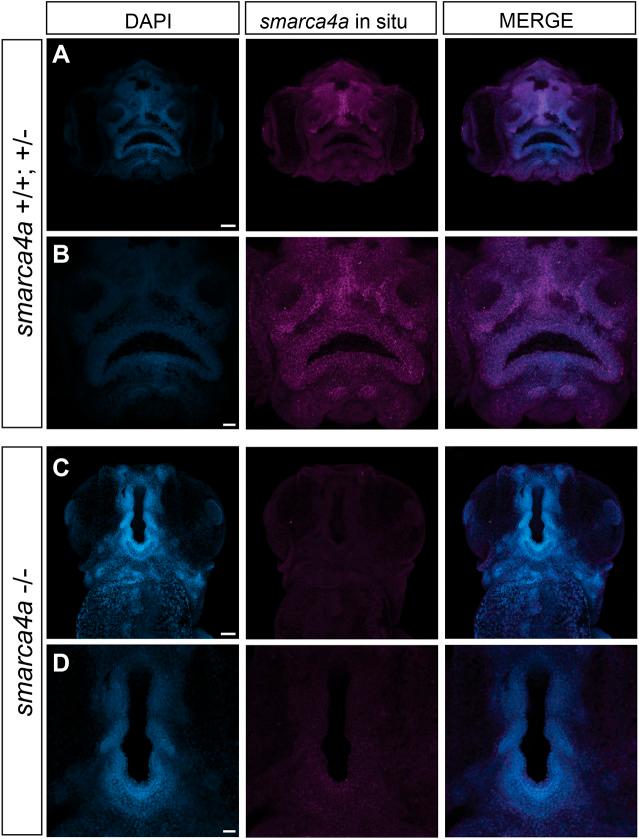 https://cdn.ncbi.nlm.nih.gov/pmc/blobs/f6a3/10245138/200fcb3f6e93/dmm-16-049868-g5.jpg