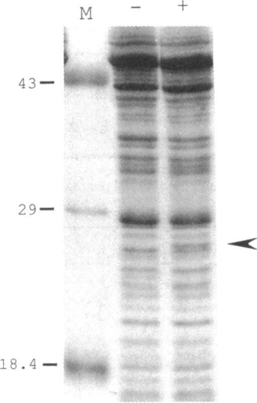 https://cdn.ncbi.nlm.nih.gov/pmc/blobs/f6a5/206055/9c7dd6d53970/jbacter00077-0255-b.jpg