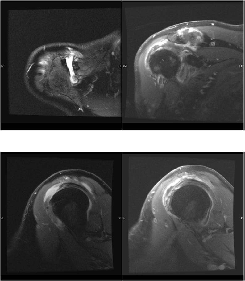 https://cdn.ncbi.nlm.nih.gov/pmc/blobs/f6ae/7921498/8bf0182a016c/gr2.jpg