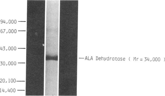 https://cdn.ncbi.nlm.nih.gov/pmc/blobs/f6b1/436912/d6798a5315d3/jcinvest00152-0221-a.jpg