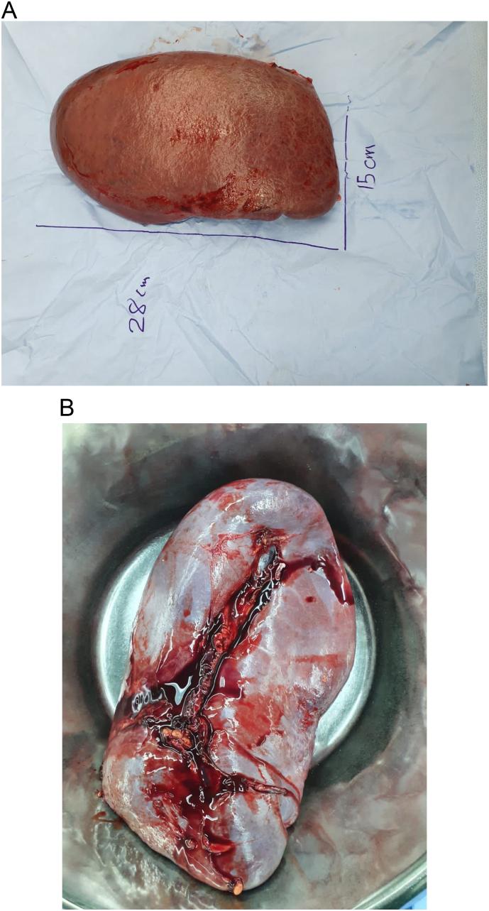 https://cdn.ncbi.nlm.nih.gov/pmc/blobs/f6b2/10509882/520d68e79bbe/gr3.jpg