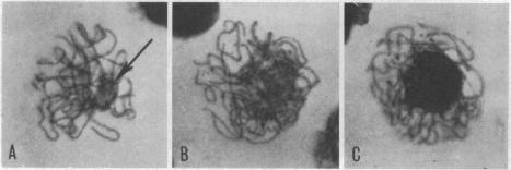 https://cdn.ncbi.nlm.nih.gov/pmc/blobs/f6b4/225083/41665edace41/pnas00120-0215-a.jpg