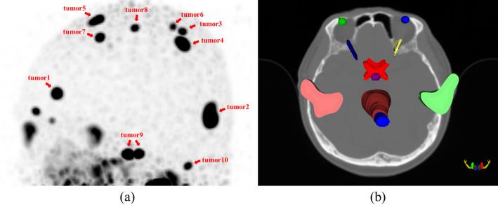https://cdn.ncbi.nlm.nih.gov/pmc/blobs/f6b9/12214214/b9d816b924ab/40658_2025_781_Fig1_HTML.jpg