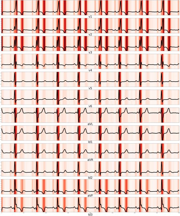 https://cdn.ncbi.nlm.nih.gov/pmc/blobs/f6ba/9463260/0d7fcd42fade/11255_2022_3165_Fig3_HTML.jpg