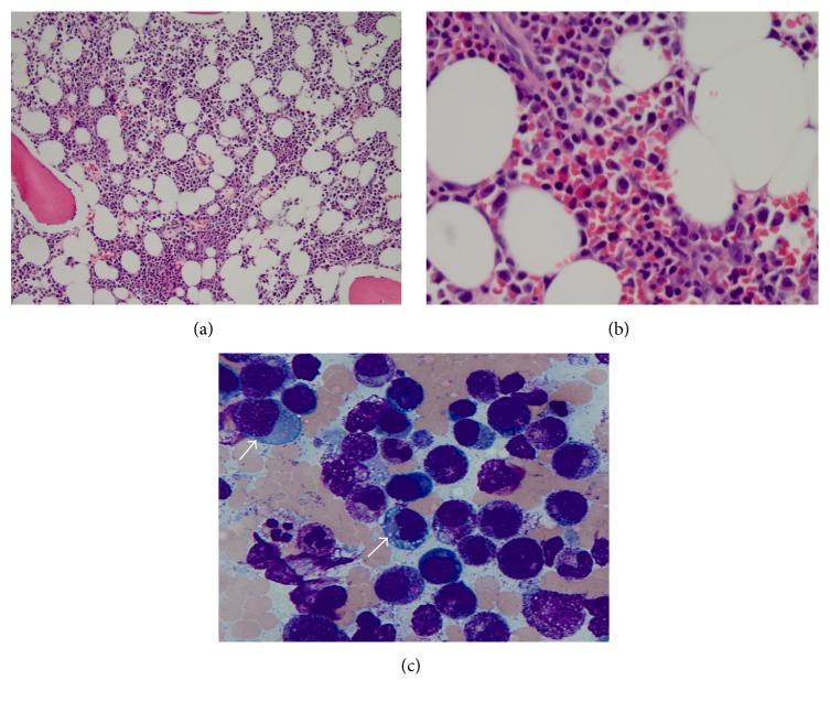 https://cdn.ncbi.nlm.nih.gov/pmc/blobs/f6bb/5632856/06ea27bd84de/CRIHEM2017-7292148.004.jpg