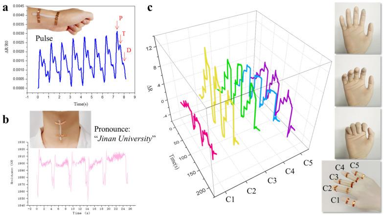 https://cdn.ncbi.nlm.nih.gov/pmc/blobs/f6bf/12293851/300c45073913/biosensors-15-00412-g006.jpg