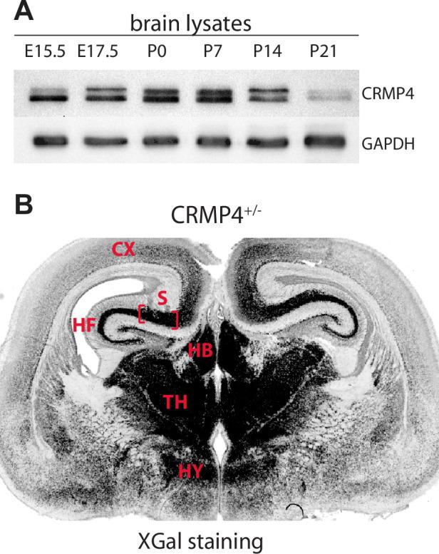 https://cdn.ncbi.nlm.nih.gov/pmc/blobs/f6ca/8683083/0cac252a2d5e/elife-70361-fig3-figsupp1.jpg