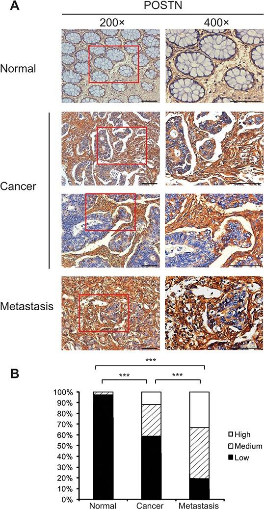 https://cdn.ncbi.nlm.nih.gov/pmc/blobs/f6d8/4808034/b10390bf0a35/oncotarget-07-0798-g001.jpg