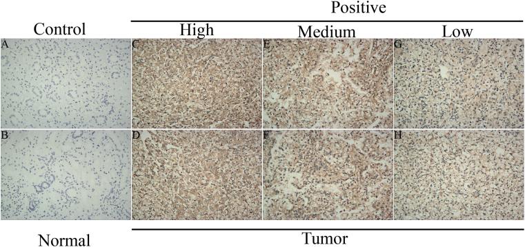 https://cdn.ncbi.nlm.nih.gov/pmc/blobs/f6dc/9922818/c4650ef5f61d/gr2.jpg