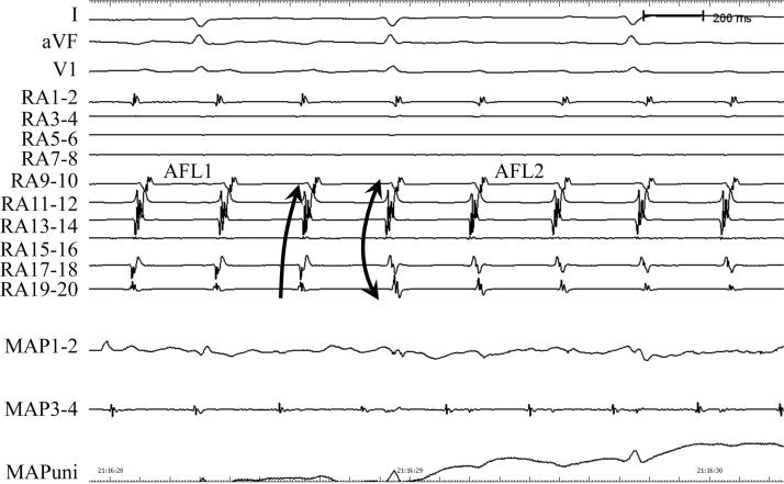 https://cdn.ncbi.nlm.nih.gov/pmc/blobs/f6de/5412605/3a9d506cef27/gr2.jpg