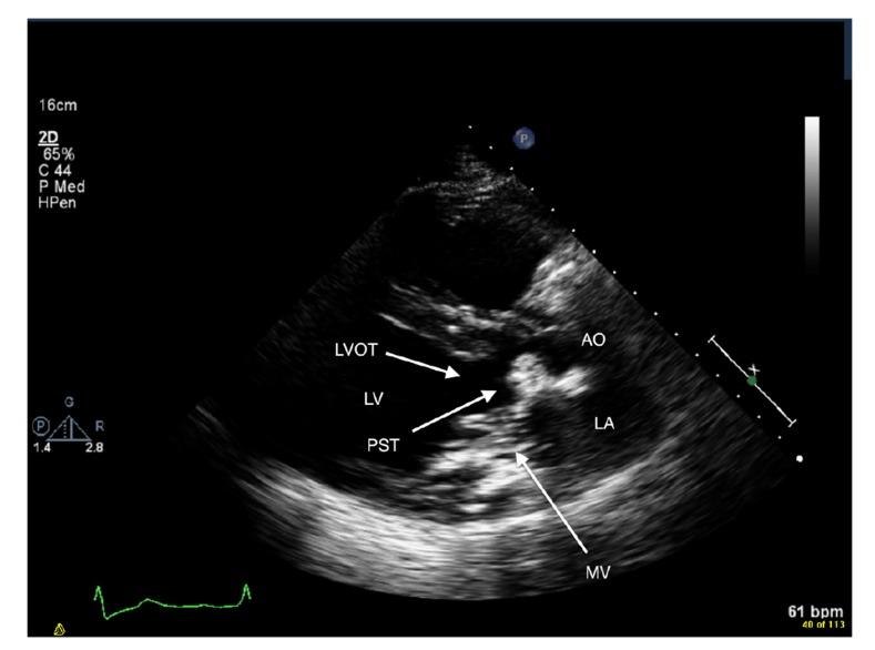 https://cdn.ncbi.nlm.nih.gov/pmc/blobs/f6e1/5120388/0ffe711ee7cf/TOCMJ-10-221_F1.jpg