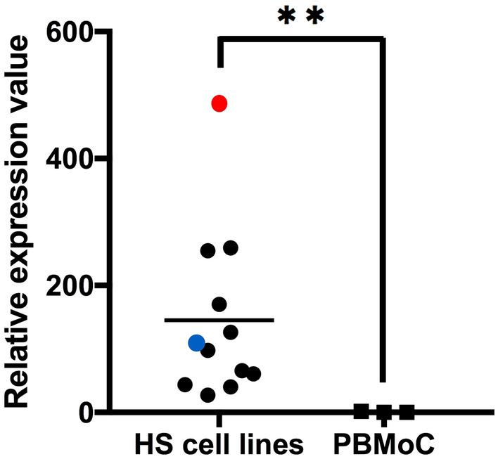 https://cdn.ncbi.nlm.nih.gov/pmc/blobs/f6e3/10212919/eead8acfb495/41598_2023_35813_Fig3_HTML.jpg
