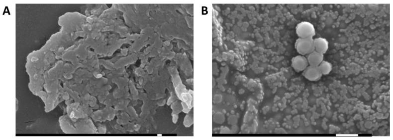 https://cdn.ncbi.nlm.nih.gov/pmc/blobs/f6ef/10298032/67c3bda12a45/gels-09-00448-g003.jpg