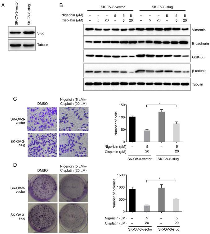 https://cdn.ncbi.nlm.nih.gov/pmc/blobs/f6f3/8358618/fee7c4ad3b89/ol-22-04-12961-g04.jpg